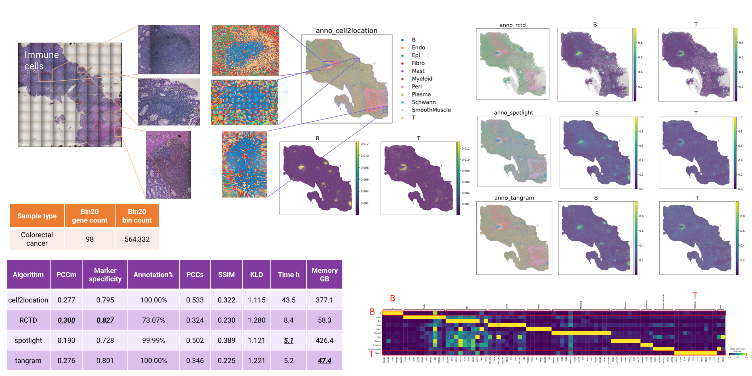 Figure 8 cell type annotation of human colorectal cancer bin20 data